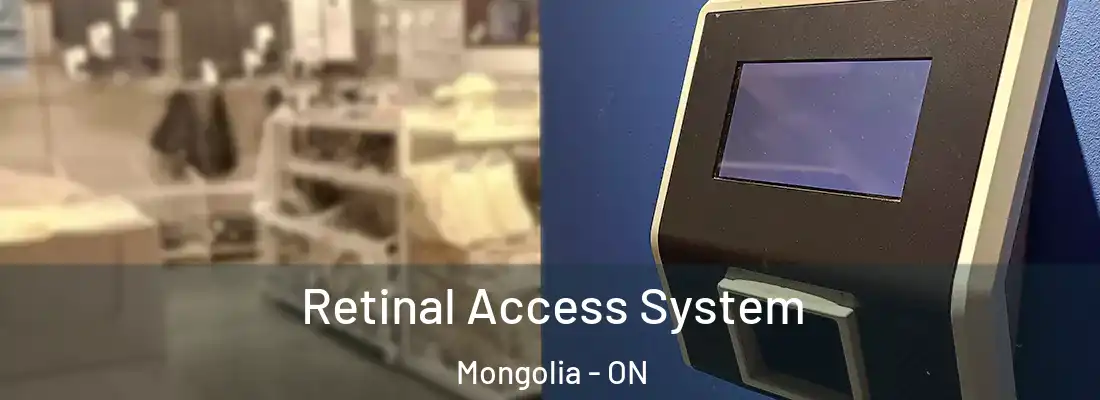  Retinal Access System Mongolia - ON