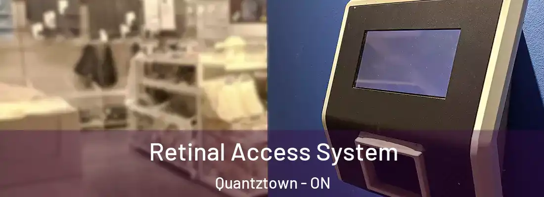  Retinal Access System Quantztown - ON